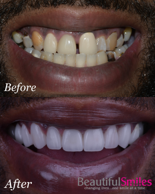 Beautiful Smiles | Orthodontics, Invisalign reg  and CEREC reg  Crowns