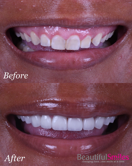 Dentist in Plantation