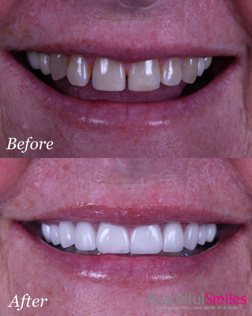 Cosmetic Dentist in Plantation