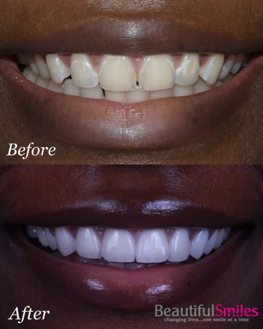 Beautiful Smiles | Botox reg , Pediatric Dentistry and Laser Dentistry